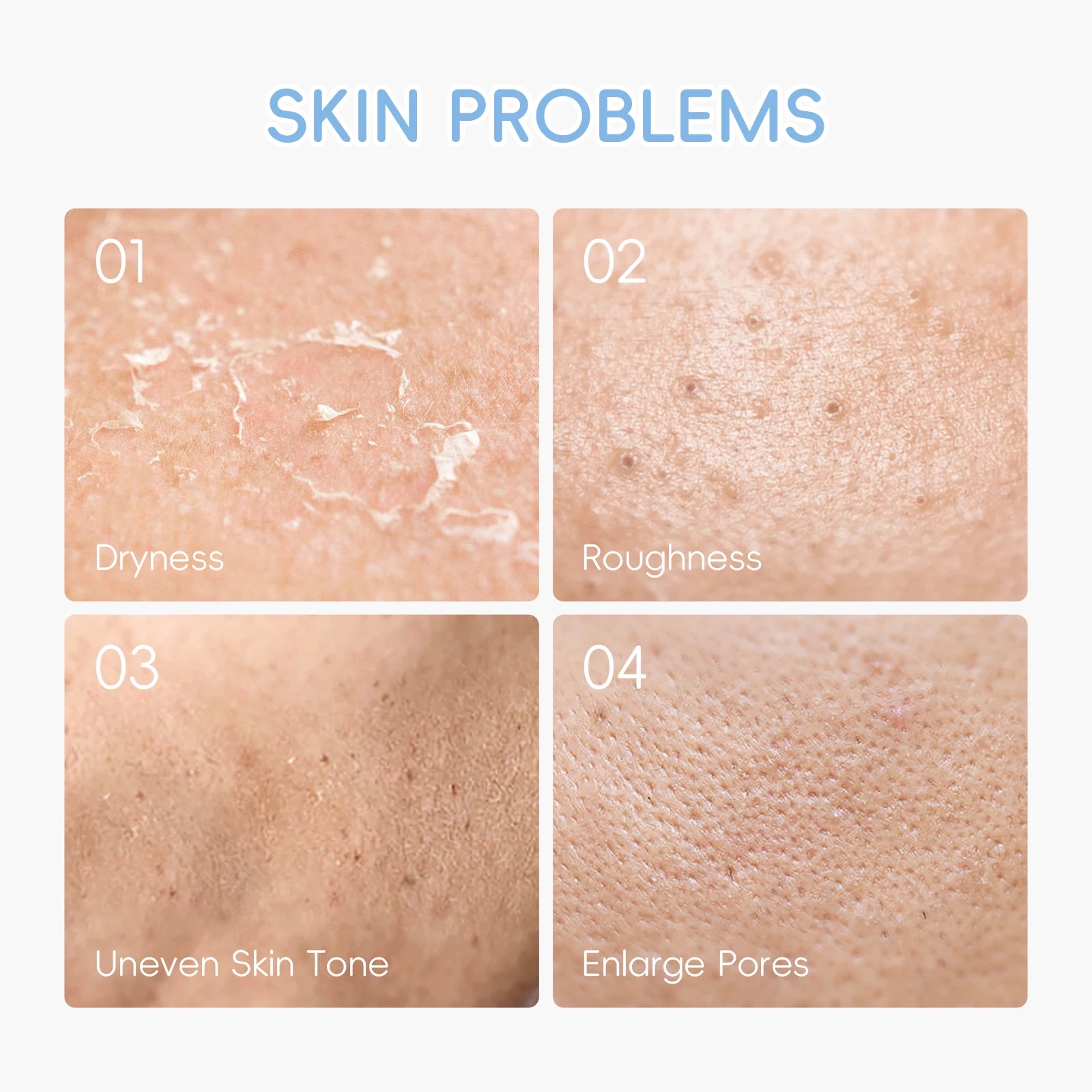 Coffret Soin Peau - Bloom - Bloom